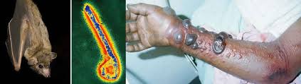 Marburg virus transmission, disease, symptoms, diagnosis & treatment